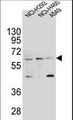 LILRA2 / CD85h / ILT1 Antibody - LILRA2 Antibody western blot of NCI-H292,NCI-H460 and A549 cell line lysates (35 ug/lane). The LILRA2 antibody detected the LILRA2 protein (arrow).