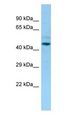 LILRA3 / CD85e Antibody - LILRA3 antibody Western Blot of OVCAR-3.  This image was taken for the unconjugated form of this product. Other forms have not been tested.