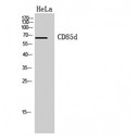 LILRB2 / ILT4 Antibody - Western blot of CD85d antibody