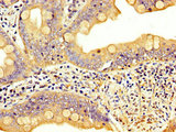 LIM Protein / LPP Antibody - Immunohistochemistry image at a dilution of 1:300 and staining in paraffin-embedded human small intestine tissue performed on a Leica BondTM system. After dewaxing and hydration, antigen retrieval was mediated by high pressure in a citrate buffer (pH 6.0) . Section was blocked with 10% normal goat serum 30min at RT. Then primary antibody (1% BSA) was incubated at 4 °C overnight. The primary is detected by a biotinylated secondary antibody and visualized using an HRP conjugated SP system.