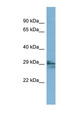 LIM2 Antibody - LIM2 antibody Western blot of COLO205 cell lysate. This image was taken for the unconjugated form of this product. Other forms have not been tested.