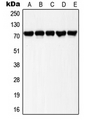 LIMK1 + LIMK2 Antibody - Western blot analysis of LIMK1/2 (pT508/505) expression in HeLa UV-treated (A); Raw264.7 UV-treated (B); A431 (C); NIH3T3 (D); PC12 (E) whole cell lysates.