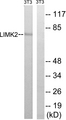 LIMK2 Antibody - Western blot analysis of lysates from NIH/3T3 cells, treated with PMA 125ng/ml 30', using LIMK2 Antibody. The lane on the right is blocked with the synthesized peptide.