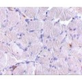 LIMPII / SCARB2 Antibody - Immunohistochemistry of LIMP2 in human skeletal muscle tissue with LIMP2 antibody at 10 µg/mL.