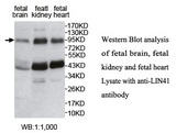 LIN41 / TRIM71 Antibody