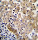 LIN7C / VELI3 Antibody - LIN7C Antibody immunohistochemistry of formalin-fixed and paraffin-embedded human liver tissue followed by peroxidase-conjugated secondary antibody and DAB staining.