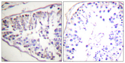 LIPE / HSL Antibody - Immunohistochemistry analysis of paraffin-embedded human tonsil tissue, using HSL Antibody. The picture on the right is blocked with the synthesized peptide.