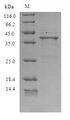 Saxiphilin Protein - (Tris-Glycine gel) Discontinuous SDS-PAGE (reduced) with 5% enrichment gel and 15% separation gel.