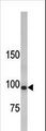 LLGL1 / HUGL Antibody - Western blot of anti-hLLGL1 antibody in 293 cell line lysate. hLLGL1(arrow) was detected using the purified antibody.