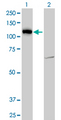LLGL2 Antibody - Western blot of LLGL2 expression in transfected 293T cell line by LLGL2 monoclonal antibody (M06), clone 4G2.