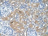 LMAN2 / VIP36 Antibody - LMAN2 antibody LMAN2(lectin, mannose-binding 2) Antibody was used in IHC to stain formalin-fixed, paraffin-embedded human kidney.  This image was taken for the unconjugated form of this product. Other forms have not been tested.