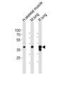 LMCD1 Antibody - Western blot of lysates from human skeletal muscle, mouse lung, rat lung tissue lysate (from left to right), using LMCD1 antibody diluted at 1:1000 at each lane. A goat anti-rabbit IgG H&L (HRP) at 1:10000 dilution was used as the secondary antibody. Lysates at 20 ug per lane.