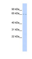 LMNB1 / Lamin B1 Antibody - LMNB1 / Lamin B1 antibody Western blot of SK-MEL-2 cell lysate. This image was taken for the unconjugated form of this product. Other forms have not been tested.