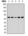 LMNB1 / Lamin B1 Antibody - Western blot analysis of Lamin B1 expression in MCF7 (A); A549 (B); SKOV3 (C); mouse brain (D); mouse liver (E) whole cell lysates.