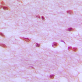 LMNB1 / Lamin B1 Antibody - Immunohistochemical analysis of Lamin B1 staining in human brain formalin fixed paraffin embedded tissue section. The section was pre-treated using heat mediated antigen retrieval with sodium citrate buffer (pH 6.0). The section was then incubated with the antibody at room temperature and detected using an HRP conjugated compact polymer system. DAB was used as the chromogen. The section was then counterstained with hematoxylin and mounted with DPX.