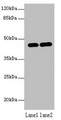 LMNTD1 / IFLTD1 Antibody - Western blot All lanes: LMNTD1 antibody at 12µg/ml Lane 1: MCF-7 whole cell lysate Lane 2: Mouse liver tissue Secondary Goat polyclonal to rabbit IgG at 1/10000 dilution Predicted band size: 44, 34, 37, 42, 46 kDa Observed band size: 44 kDa