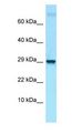 LMO2 Antibody - LMO2 antibody Western Blot of Mouse Testis.  This image was taken for the unconjugated form of this product. Other forms have not been tested.