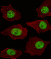 LMO4 Antibody - Fluorescent image of A549 cell stained with LMO4 Antibody. A549 cells were fixed with 4% PFA (20 min), permeabilized with Triton X-100 (0.1%, 10 min), then incubated with LMO4 primary antibody (1:25, 1 h at 37°C). For secondary antibody, Alexa Fluor 488 conjugated donkey anti-rabbit antibody (green) was used (1:400, 50 min at 37°C). Cytoplasmic actin was counterstained with Alexa Fluor 555 (red) conjugated Phalloidin (7units/ml, 1 h at 37°C). LMO4 immunoreactivity is localized to Nucleus significantly.