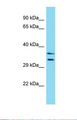 LMOD3 Antibody - Western blot of Human HCT15. LMOD3 antibody dilution 1.0 ug/ml.  This image was taken for the unconjugated form of this product. Other forms have not been tested.
