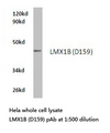 LMX1B Antibody - Western blot of LMX1B (D159) pAb in extracts from HeLa cells.