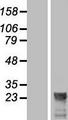 LOC285908 Protein - Western validation with an anti-DDK antibody * L: Control HEK293 lysate R: Over-expression lysate