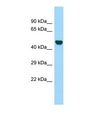 LOC304396 Antibody - Western blot of Rat Kidney. LOC304396 antibody dilution 1.0 ug/ml.  This image was taken for the unconjugated form of this product. Other forms have not been tested.