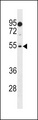 LOC391003 / PRAMEF18 Antibody - PRAMEF18 Antibody western blot of HepG2 cell line lysates (35 ug/lane). The PRAMEF18 antibody detected the PRAMEF18 protein (arrow).