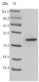 LYZ / Lysozyme Protein - (Tris-Glycine gel) Discontinuous SDS-PAGE (reduced) with 5% enrichment gel and 15% separation gel.