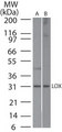LOX / Lysyl Oxidase Antibody - Western blot of LOX in A) human skin and B) mouse ear skin lysate using Polyclonal Antibody to Lysyl Oxidase (LOX) at 1:500. Goat anti-rabbit Ig HRP secondary antibody, and PicoTect ECL substrate solution, were used for this test.