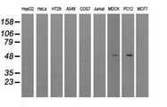 LOX / Lysyl Oxidase Antibody - IHC of paraffin-embedded colon tissue using anti- mouse monoclonal antibody. (Dilution 1:50).