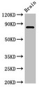 LOXL4 / LOXC Antibody - Western Blot Positive WB detected in:Rat brain tissue All Lanes:Loxl4 antibody at 4µg/ml Secondary Goat polyclonal to rabbit IgG at 1/50000 dilution Predicted band size: 85 KDa Observed band size: 85 KDa
