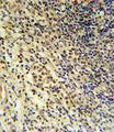 LP-PLA2 / PLA2G7 Antibody - PLA2G7 Antibody IHC of formalin-fixed and paraffin-embedded tonsil followed by peroxidase-conjugated secondary antibody and DAB staining.