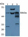 LP-PLA2 / PLA2G7 Antibody - Western Blot; Sample: Lane1: Rat Serum; Lane2: Mouse Serum; Lane3: Mouse Brain Tissue.