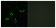 LPAR2 / EDG4 Antibody - Immunofluorescence analysis of LOVO cells, using EDG4 Antibody. The picture on the right is blocked with the synthesized peptide.