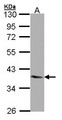 LPAR3 / LPA3 / EDG7 Antibody - Sample (30 ug of whole cell lysate). A: A431. 10% SDS PAGE. LPAR3 antibody diluted at 1:1000. 