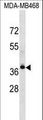 LPAR4 / GPR23 Antibody - LPAR4 Antibody western blot of MDA-MB468 cell line lysates (35 ug/lane). The LPAR4 antibody detected the LPAR4 protein (arrow).