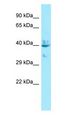 LPAR4 / GPR23 Antibody - LPAR4 / GPR23 antibody Western Blot of 293T.  This image was taken for the unconjugated form of this product. Other forms have not been tested.