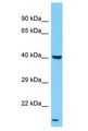 LPAR6 / P2RY5 / P2Y5 Antibody - LPAR6 / P2RY5 / P2Y5 antibody Western Blot of HeLa. Antibody dilution: 1 ug/ml.  This image was taken for the unconjugated form of this product. Other forms have not been tested.