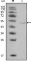 LPL / Lipoprotein Lipase Antibody - Western blot using LPL mouse monoclonal antibody against HeLa cell lysate (1).