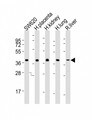 LPP3 / PPAP2B Antibody - All lanes : Anti-PPAP2B Antibody at 1:2000 dilution Lane 1: SW620 whole cell lysates Lane 2: human placenta lysates Lane 3: human kidney lysates Lane 4: human lung lysates Lane 5: rat liver lysates Lysates/proteins at 20 ug per lane. Secondary Goat Anti-Rabbit IgG, (H+L), Peroxidase conjugated at 1/10000 dilution Predicted band size : 35 kDa Blocking/Dilution buffer: 5% NFDM/TBST.