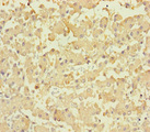 LPPR2 Antibody - Immunohistochemistry of paraffin-embedded human liver tissue at dilution 1:100