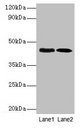 LPS regulatory protein YciM Antibody - Western blot All lanes: Lipopolysaccharide regulatory protein antibody at dilution of 1: 1000 Lane1: DH5&alpha; cell lysate at 10µg Lane2: DH5&alpha; cell lysate at 1µgSecondary Goat polyclonal to rabbit IgG at 1/10000 dilution Predicted band size: 45 kDa Observed band size: 45 kDa