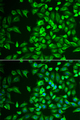 LRAT Antibody - Immunofluorescence analysis of U2OS cells.