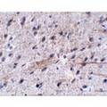 LRFN5 Antibody - Immunohistochemistry of LRFN5 in mouse brain tissue with LRFN5 antibody at 5 µg/mL.