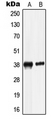 LRG1 / LRG Antibody - Western blot analysis of LRG expression in HepG2 (A); HL60 (B) whole cell lysates.