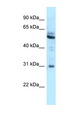 LRMP / JAW1 Antibody - LRMP antibody Western blot of A549 Cell lysate. Antibody concentration 1 ug/ml.  This image was taken for the unconjugated form of this product. Other forms have not been tested.