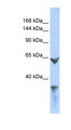LRP1 / CD91 Antibody - LRP1 / CD91 antibody Western blot of 293T cell lysate. This image was taken for the unconjugated form of this product. Other forms have not been tested.