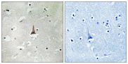 LRP10 Antibody - Immunohistochemistry analysis of paraffin-embedded human brain tissue, using LRP10 Antibody. The picture on the right is blocked with the synthesized peptide.
