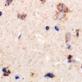 LRP10 Antibody - Immunohistochemical analysis of LRP10 staining in human brain formalin fixed paraffin embedded tissue section. The section was pre-treated using heat mediated antigen retrieval with sodium citrate buffer (pH 6.0). The section was then incubated with the antibody at room temperature and detected using an HRP conjugated compact polymer system. DAB was used as the chromogen. The section was then counterstained with haematoxylin and mounted with DPX.