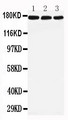 LRP5 Antibody - WB of LRP5 antibody. All lanes: Anti-LRP5 at 0.5ug/ml. Lane 1: Rat Liver Tissue Lysate at 40ug. Lane 2: Mouse Liver Tissue Lysate at 40ug. Lane 3: NIH Whole Cell Lysate at 40ug. Predicted bind size: 179KD. Observed bind size: 179KD.